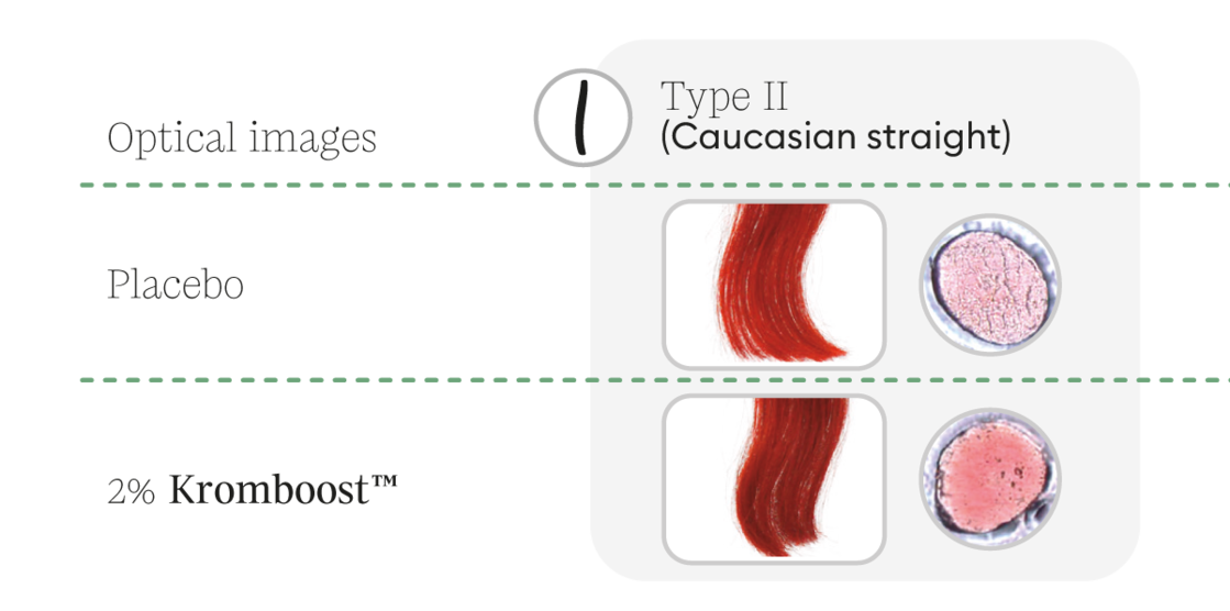 optical-hairtypeII