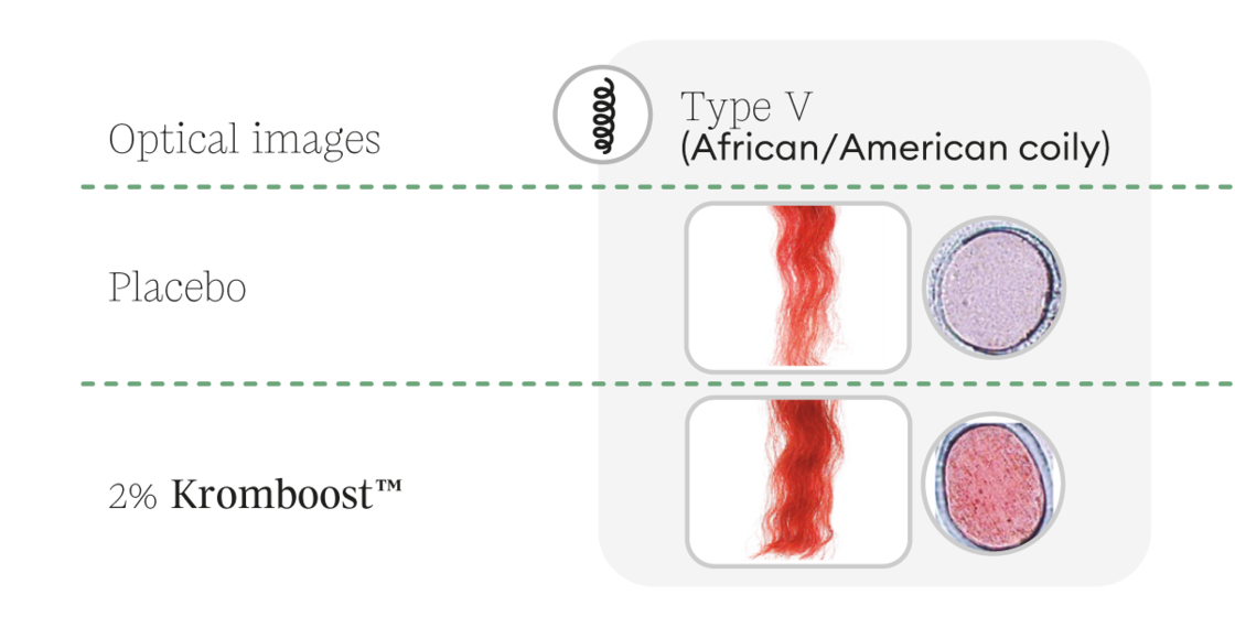 optical-hairtypeV